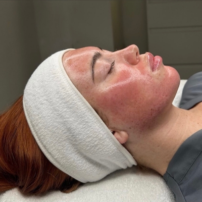 Dermaplaning