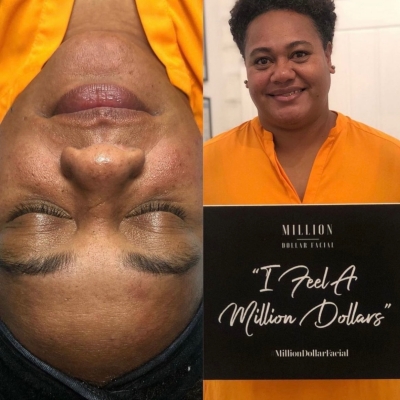 Million Dollar Facial