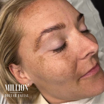 Mini Million Dollar Facial